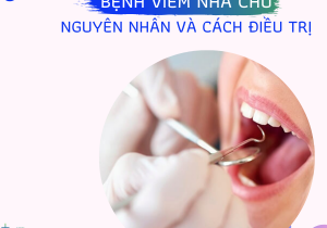 Bệnh viêm nha chu