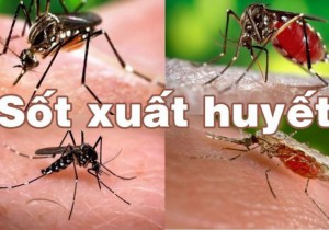 Cảnh báo sốt xuất huyết bùng phát giữa dịch COVID-19, dấu hiệu nào để phân biệt?