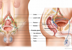 CHỦ ĐỀ SỨC KHỎE SỐ 34: TẦM SOÁT UNG THƯ TIỀN LIỆT TUYẾN