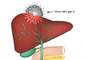 CHỦ ĐỀ SỨC KHỎE SỐ 49: NHỮNG ĐIỀU CẦN BIẾT VỀ VIÊM GAN C