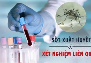 Thông báo Về việc mời chào giá các mặt hàng Test sốt xuất huyết