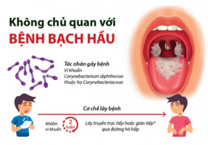 CHƯƠNG TRÌNH TƯ VẤN SỨC KHOẺ: BỆNH LÝ BẠCH HẦU