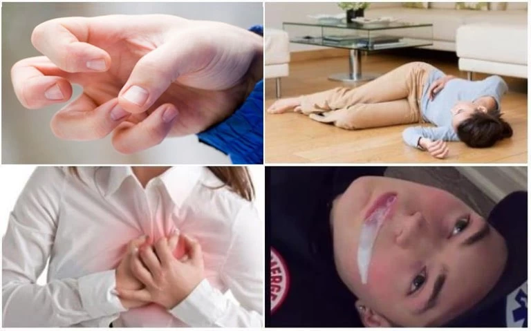 Tìm hiểu về Bệnh lý Động kinh