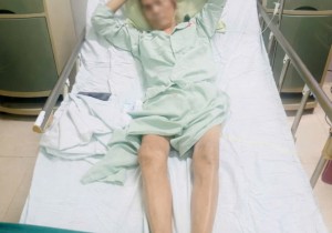 CẤP CỨU CAN THIỆP THÀNH CÔNG TRƯỜNG HỢP VỠ UNG THƯ GAN TRÊN BỆNH NHÂN CAO TUỔI TẠI BỆNH VIỆN TUYẾN KHU VỰC